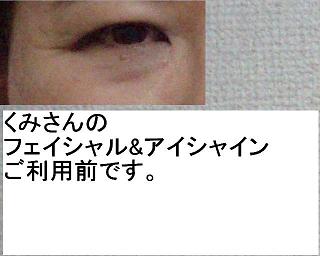ご利用前写真