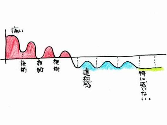 痛みとメンテのグラフ